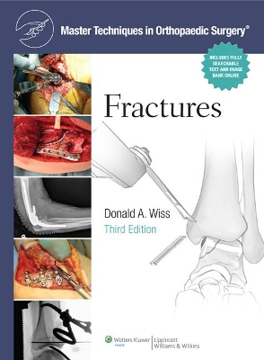 MTOS : FRACTURES 3E CB	