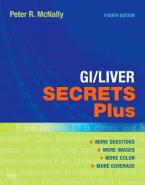 GI/LIVER SECRET PLUS 4TH ED Paperback BIG FORMAT